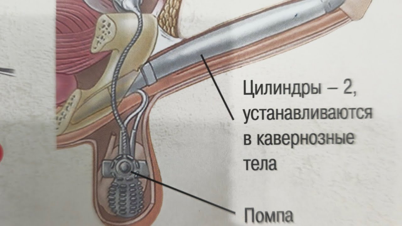 Як кори ХАТО КАРДАМ мардинагиям аз даст рафт☎️ +79969800352