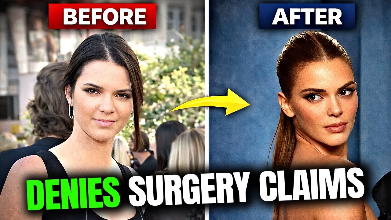Fans Accuse Kendall Jenner of Hiding Cosmetic Work—Her Response Sparks Debate!