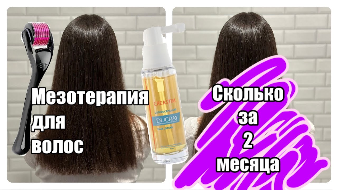 Как остановить выпадение волос. Мезотерапия/лосьон DUCRAY CREASTIM/ мезороллер 1 мм🫣