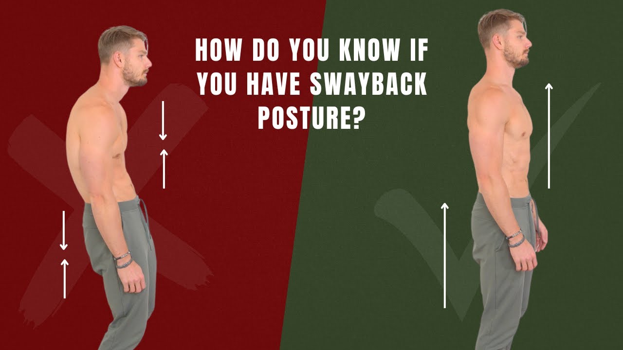 Fix Swayback Posture with Fascia Release + Exercise (10 mins/day)