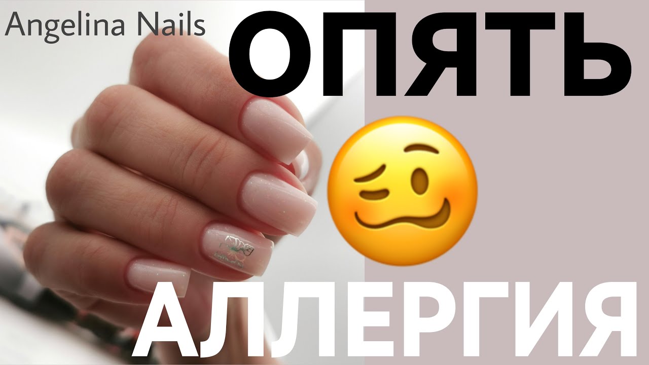 ОПЯТЬ АЛЛЕРГИЯ  у клиента / коррекция гелем без опила / гипоаллергенный только акрил / замес геля