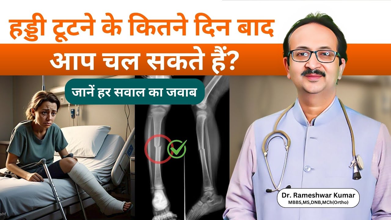 हड्डी टूटने के कितने दिन बाद आप चल सकते हैं?
