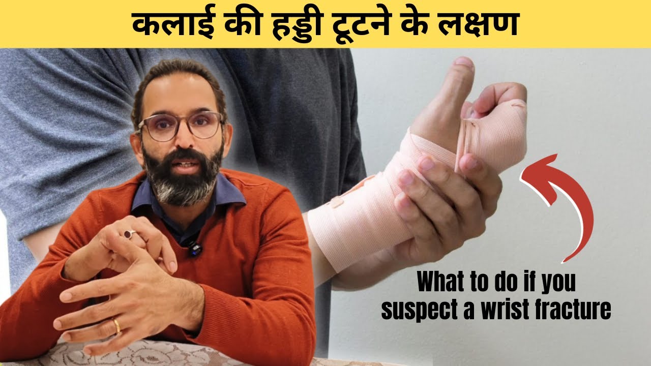 कलाई की हड्डी टूटने के लक्षण | Wrist Fracture | Scaphoid Fracture | Wrist Fracture Exercise in Hindi