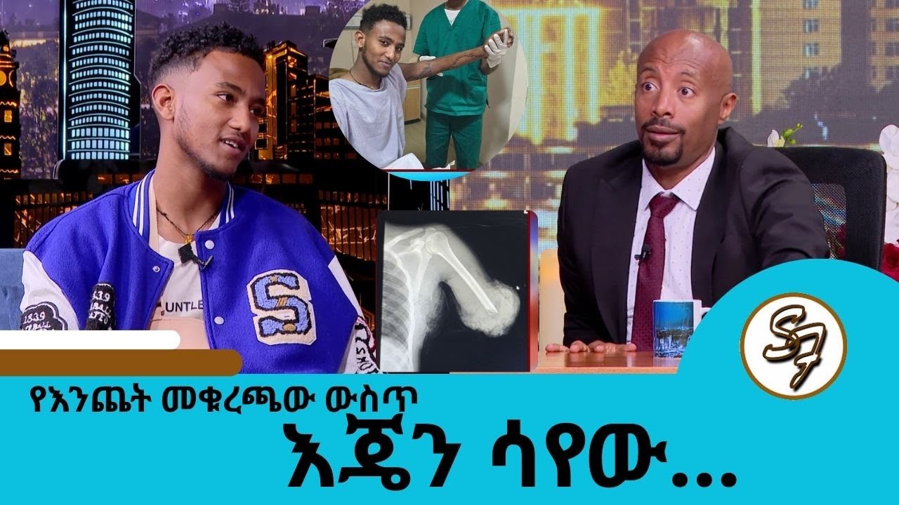 ማሽኑ እጄን ቆርጦ ሲጥለው አማተብኩ....ሙሉ በሙሉ የተቆረጠን እጅ የቀጠሉት ጀግኖች ዶክተሮቻችን  ለበአል ተከሰቱ ... | Seifu on EBS