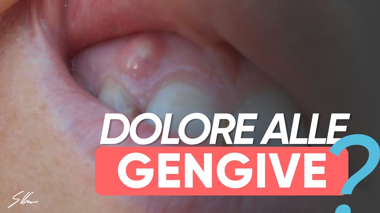 Gengive gonfie e doloranti: quando preoccuparsi?