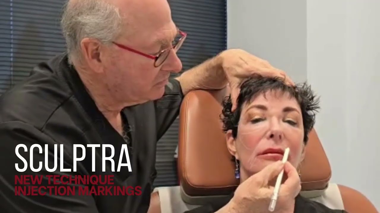 Dr. Dean Kane's New Sculptra Technique - Marking the Face