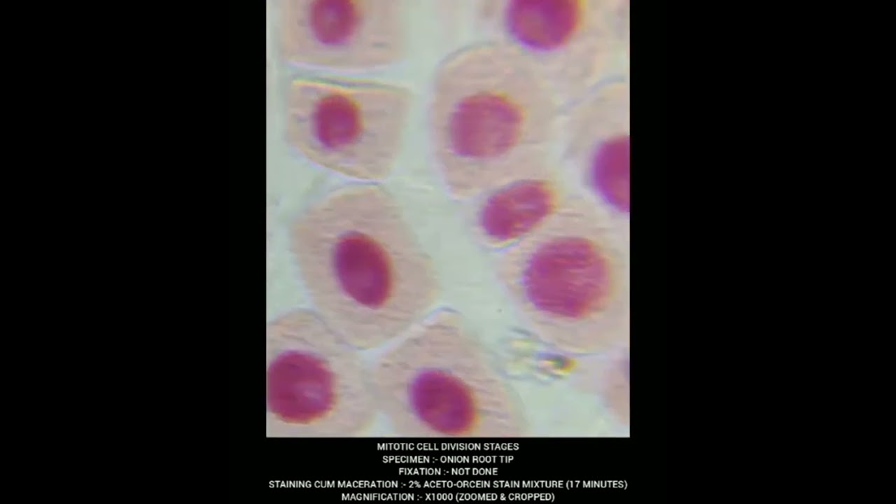 Mitosis - Cell Division different stages under Microscope #biology #neet #agriculture #genetics
