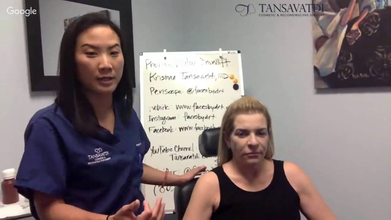 Dr. Kristina Tansavatdi Talks: The Anatomy of a Botox Brow lift Part 1of 2