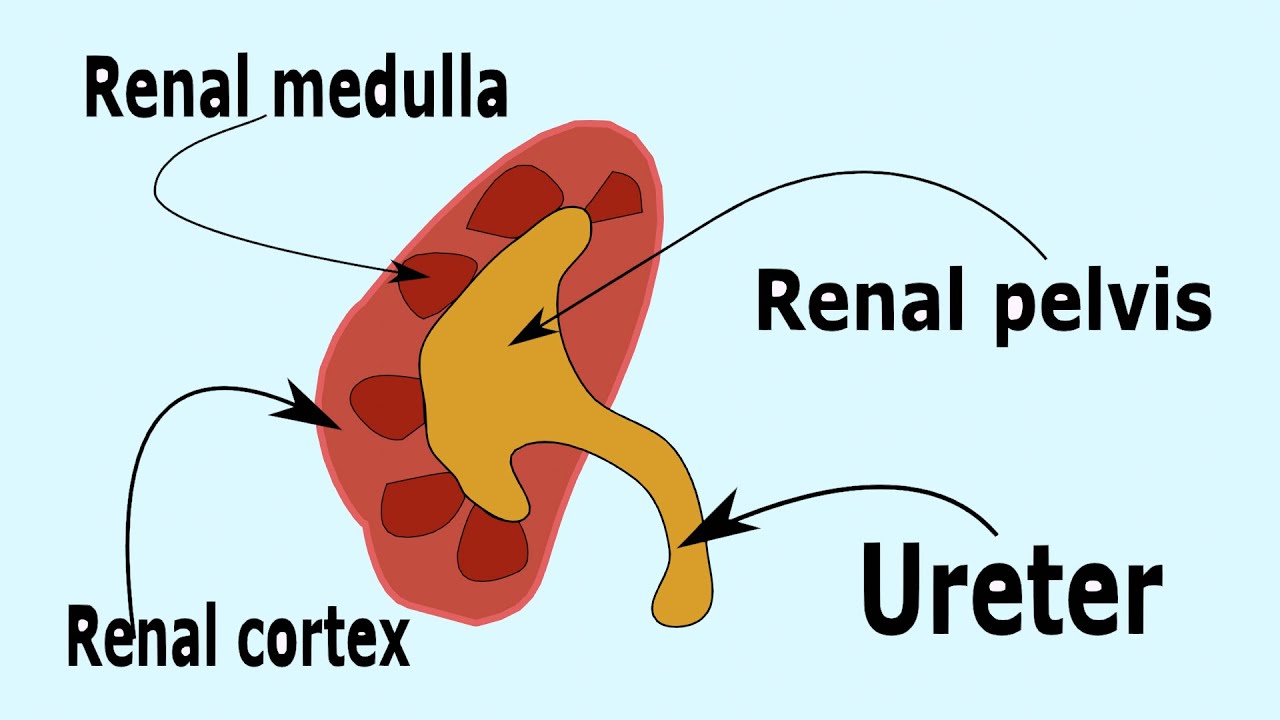 AF SOMALI KIDNEY STONES