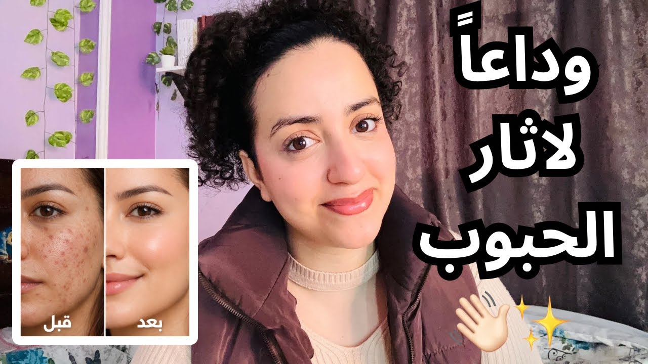 وداعًا لآثار الحبوب والتصبغات! روتين تفتيح عملي هيغير بشرتك ✨
