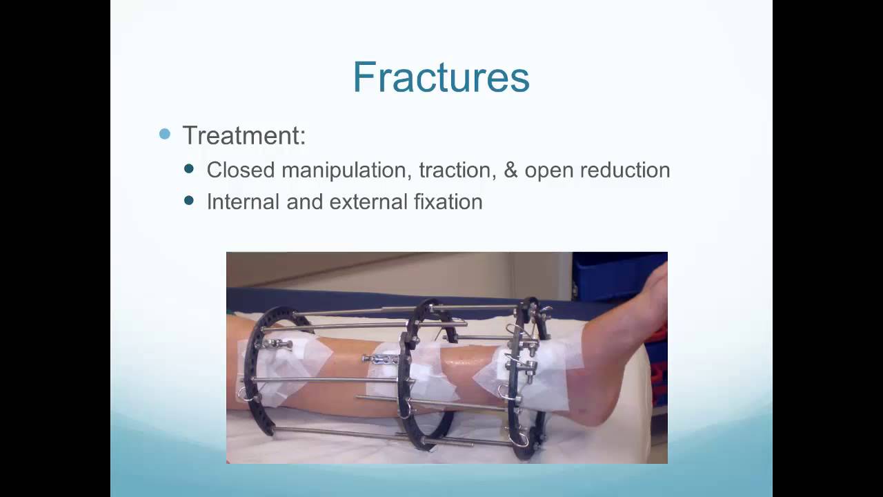 Alterations in Musculoskeletal Function