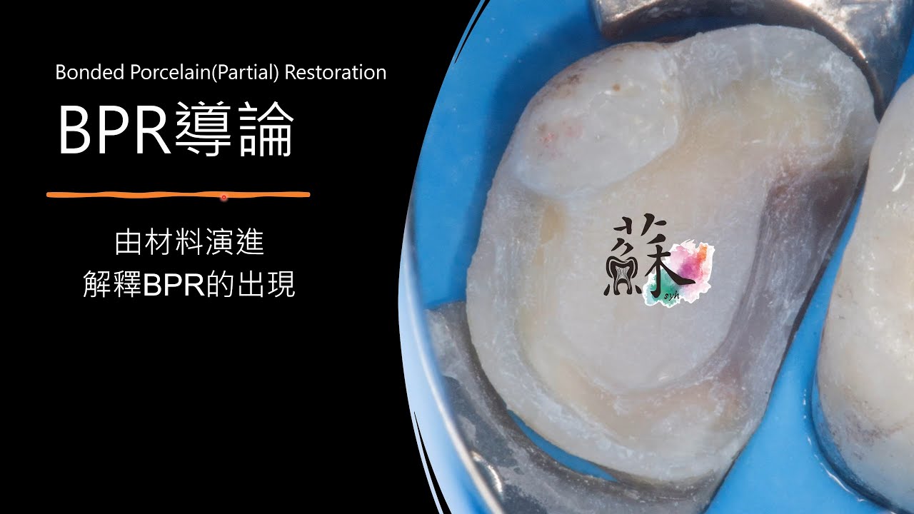 Bonded Porcelain(Partial) Restoration 導論