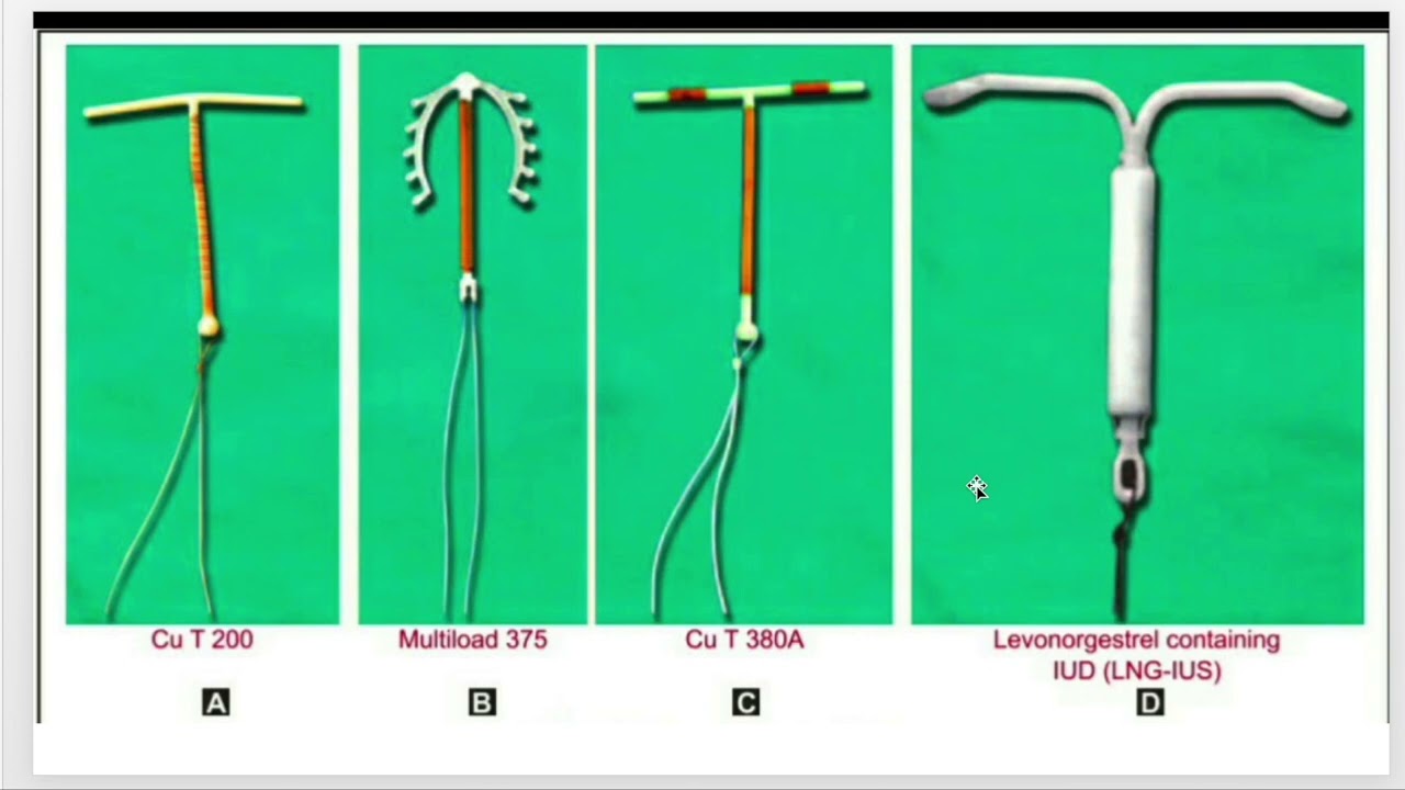 Family Planning Method & Contraception #familyplanning #condoms #Coper-t20