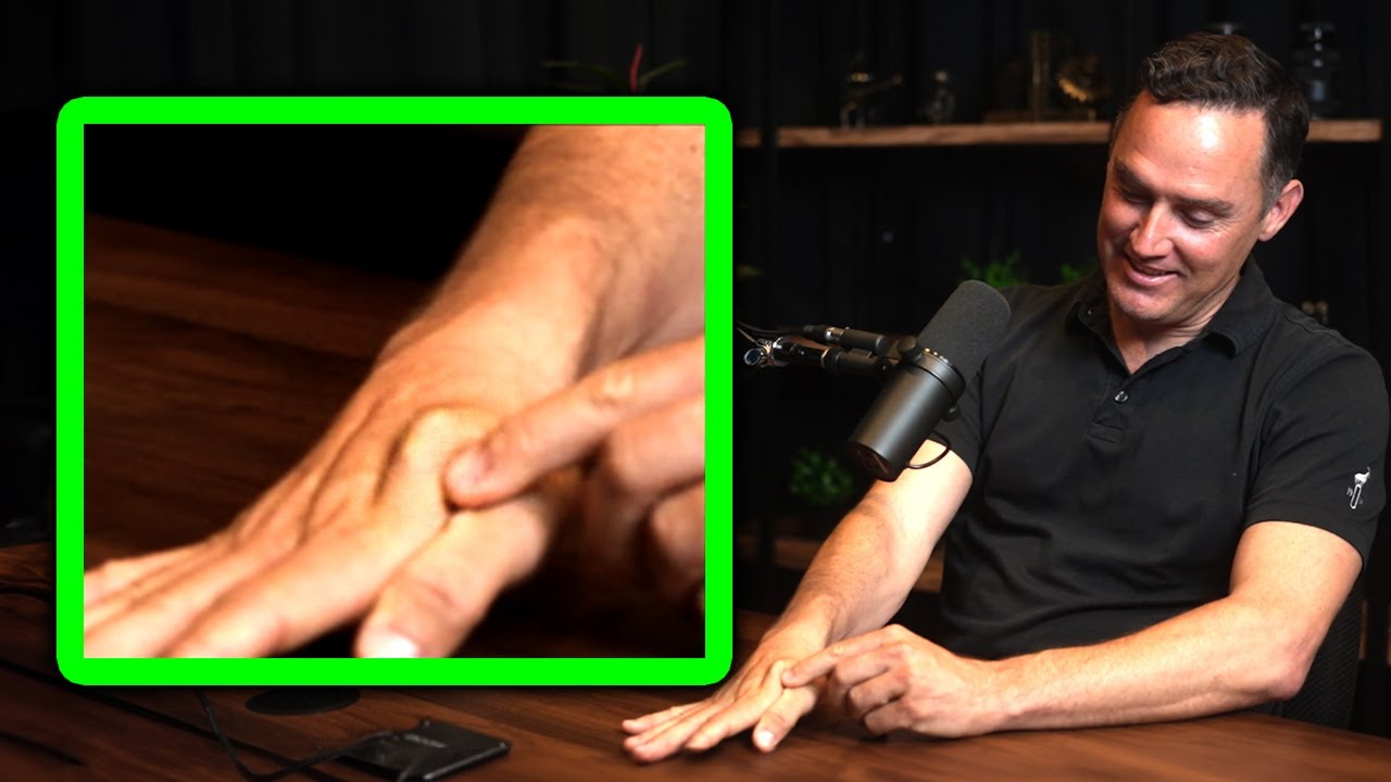 Neurosurgeon implanted RFID chip in his hand | Lex Fridman Podcast