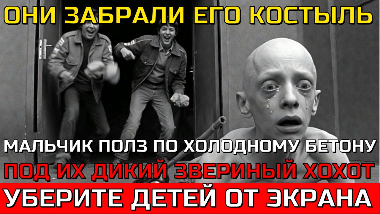 Мажоры смеялись, пока лысый мальчик полз по грязи: Жесть в СССР 80-х годов.