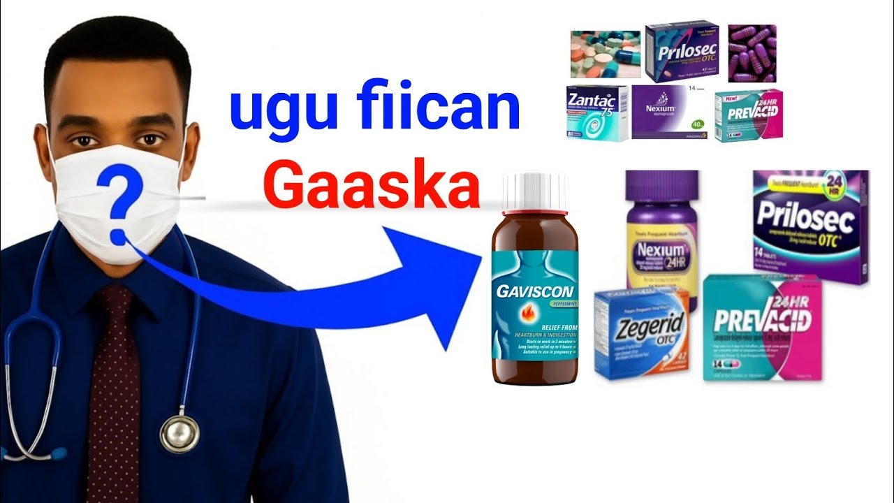 Daawooyinka ugu Fiican Xanuunka Gaaska iyo 30 Talo oo lasocoto ✅✅✅🥰