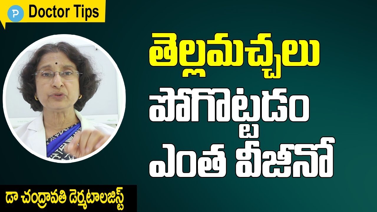 తెల్లమచ్చలు పోగొట్టడం ఎంత ఈజీనో : డెర్మాటోలజిస్ట్  డా చంద్రావతి చిట్కాలు  Remove White Patches