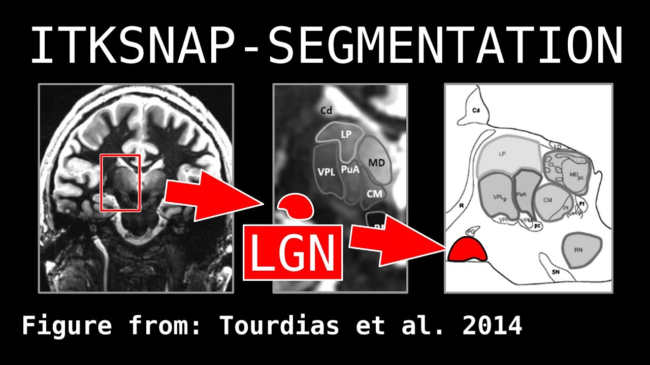 Tutorial - Intro to segmentation in ITKSNAP