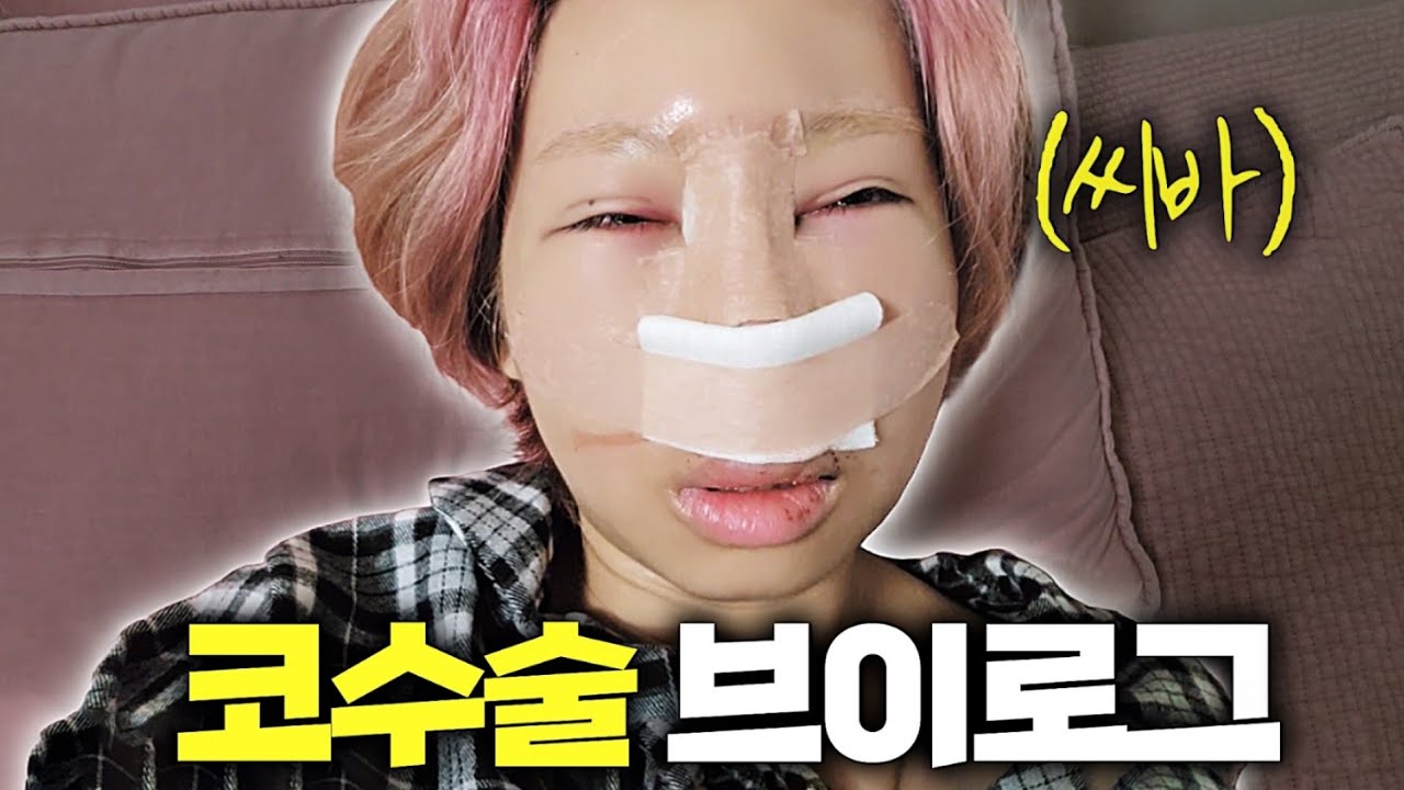 찐 현실 코수술 브이로그