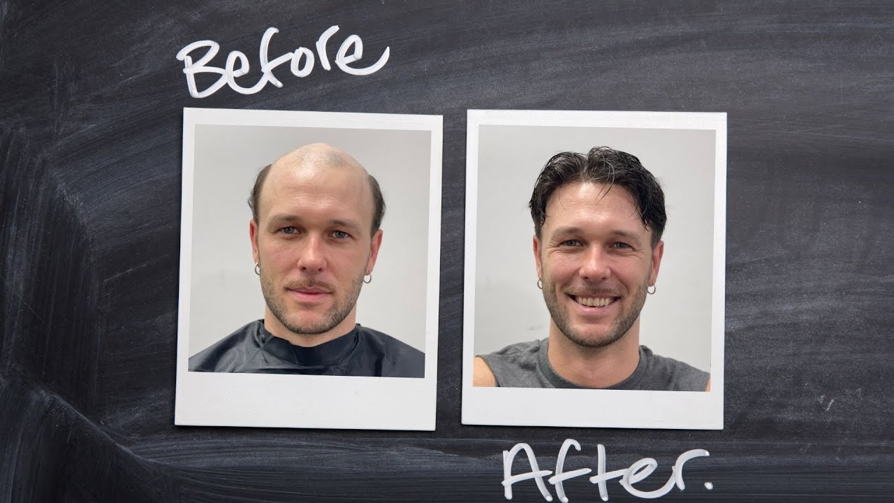 Mantenimiento prótesis capilar indetectable - Hair replacement maintenance (Igor)-Hair Inspira