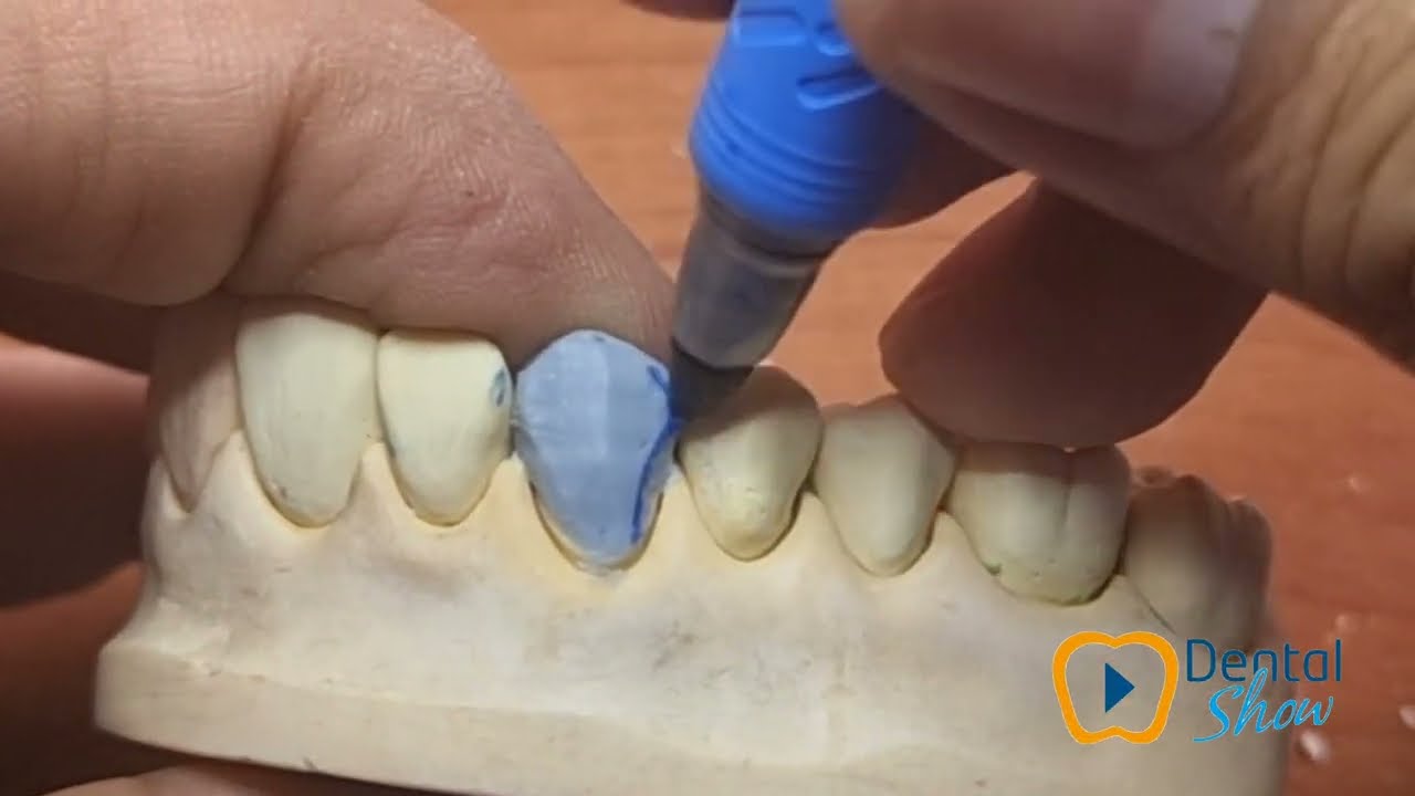 ENCERADO DENTAL 