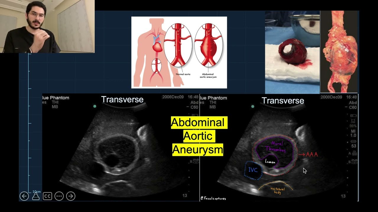 Part-5 Basic radiology course (Ultrasound) arabic