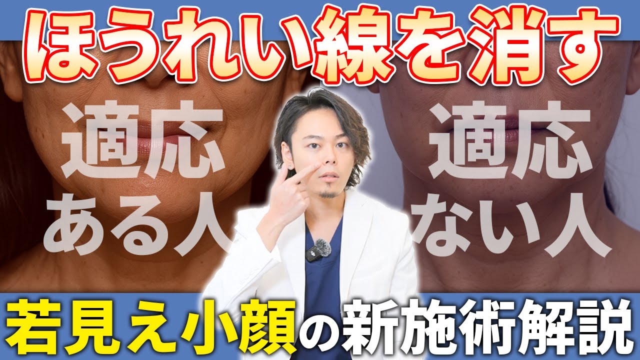 ほうれい線を消す新治療！A式ナゾラリフトが向いている人・向いていない人を医師が解説