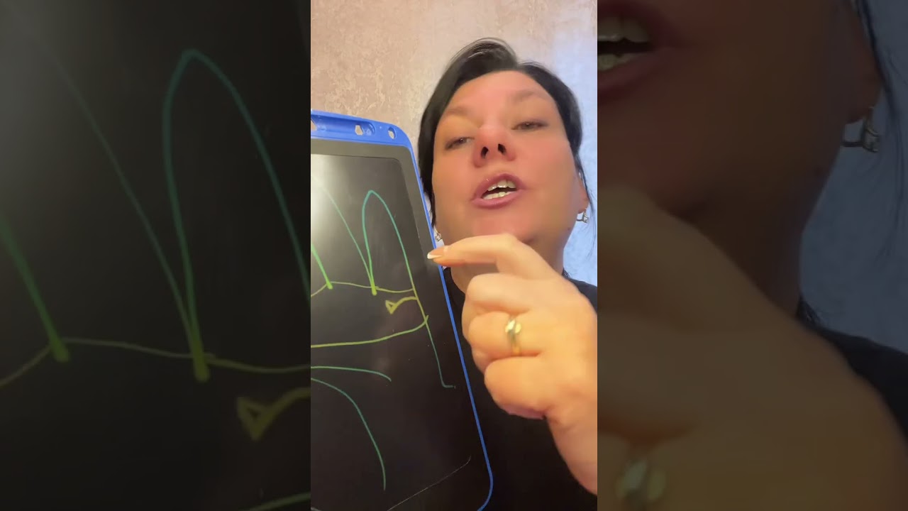 Треугольник на конце линии брака