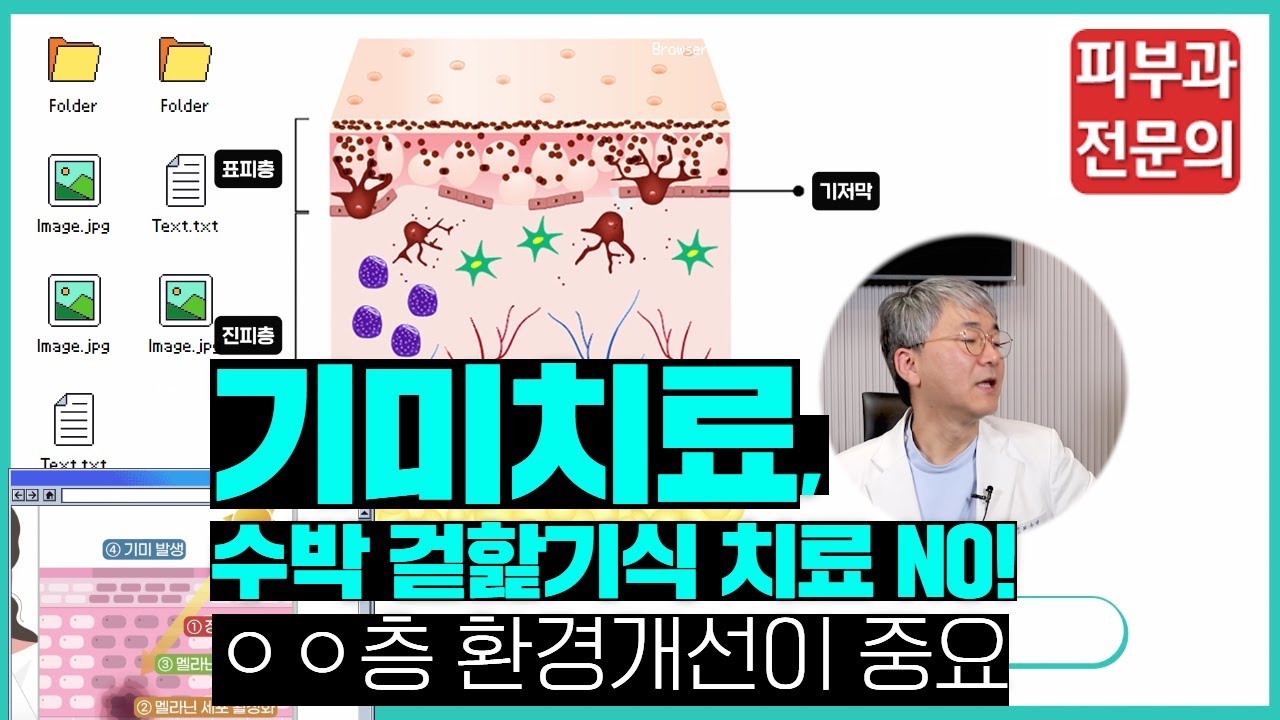 전문의가 알려주는 기미 치료, 진피환경 개선이 중요! 🧑&zwj;🎤피부과전문의 최수영 원장