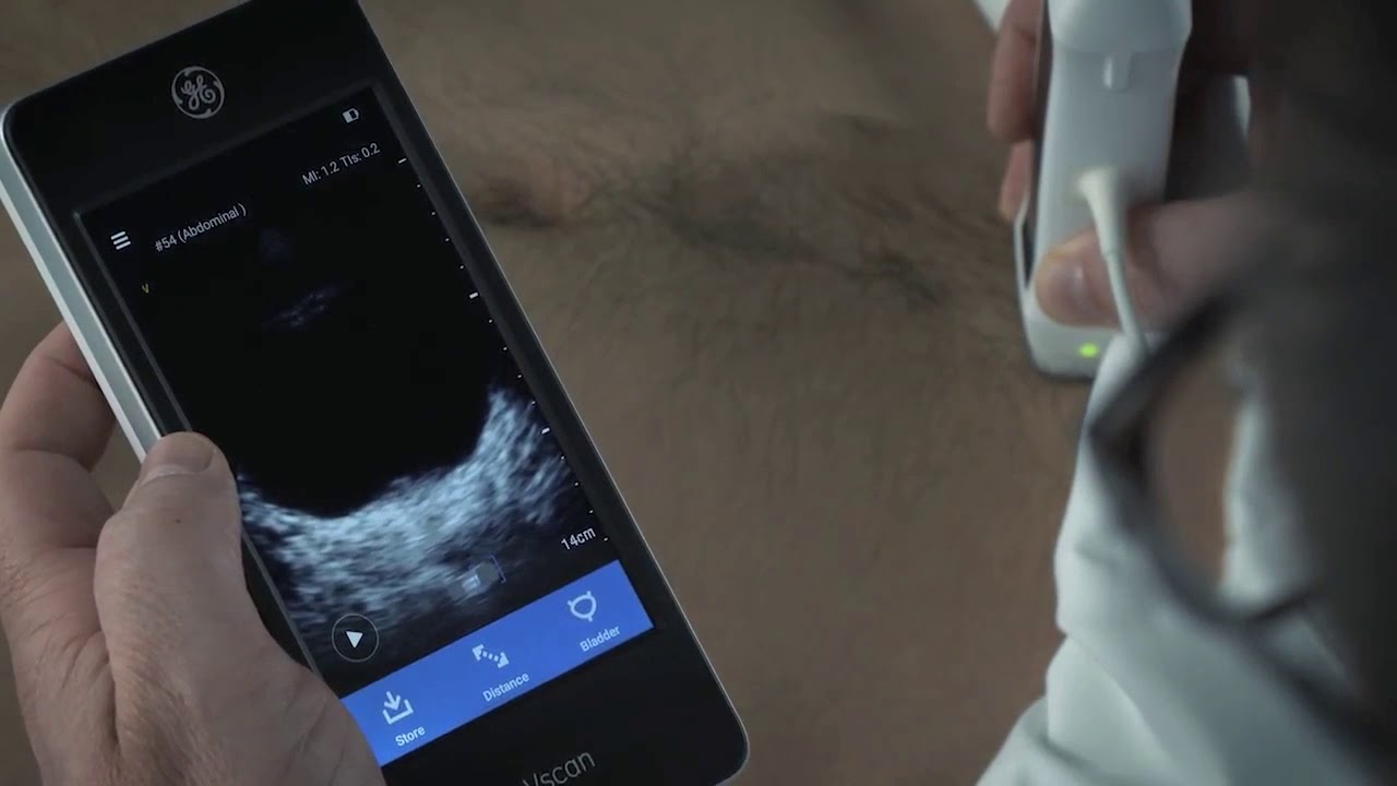 GE Vscan Extend Ultrasound - Bladder Volume App