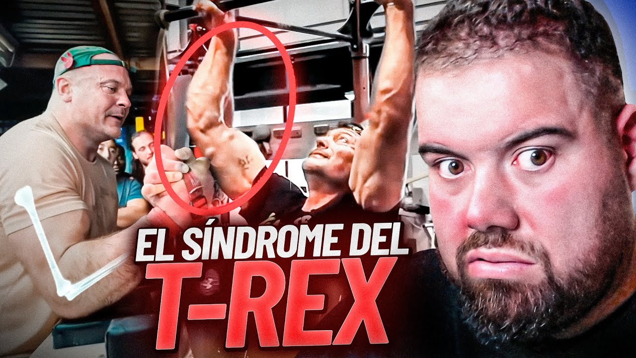 LOS ARMWRESTLER NO PUEDEN ESTIRAR EL BRAZO POR ESTO 