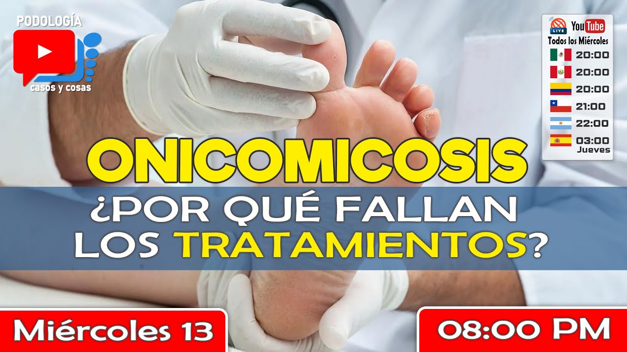 ONICOMICOSIS: ¿POR QUÉ FALLAN LOS TRATAMIENTOS? | Podología Casos y Cosas