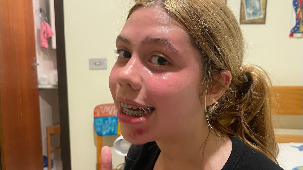 Verão 2026 - Nina caiu da Bicicleta