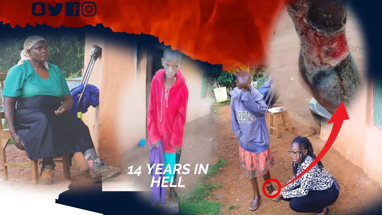 KIDONDA CHA AJABU CHAMTOKEA MGUUNI ATESEKA MIAKA 14( AGEUKA KUA MUTI)