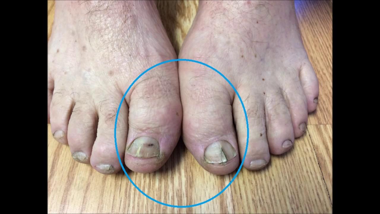 Foot Reading Video June 14 2017