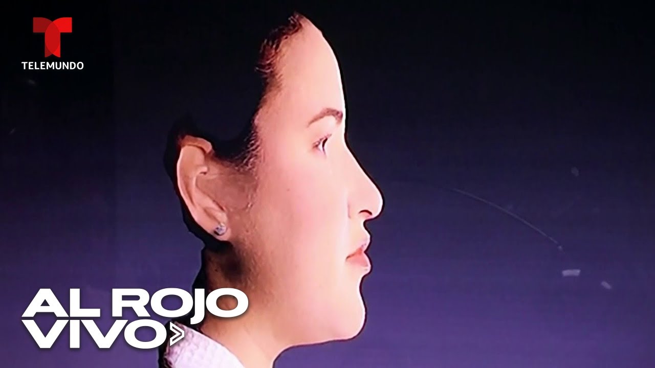 Presentan una tecnología revolucionaria para realizar la rinoplastia