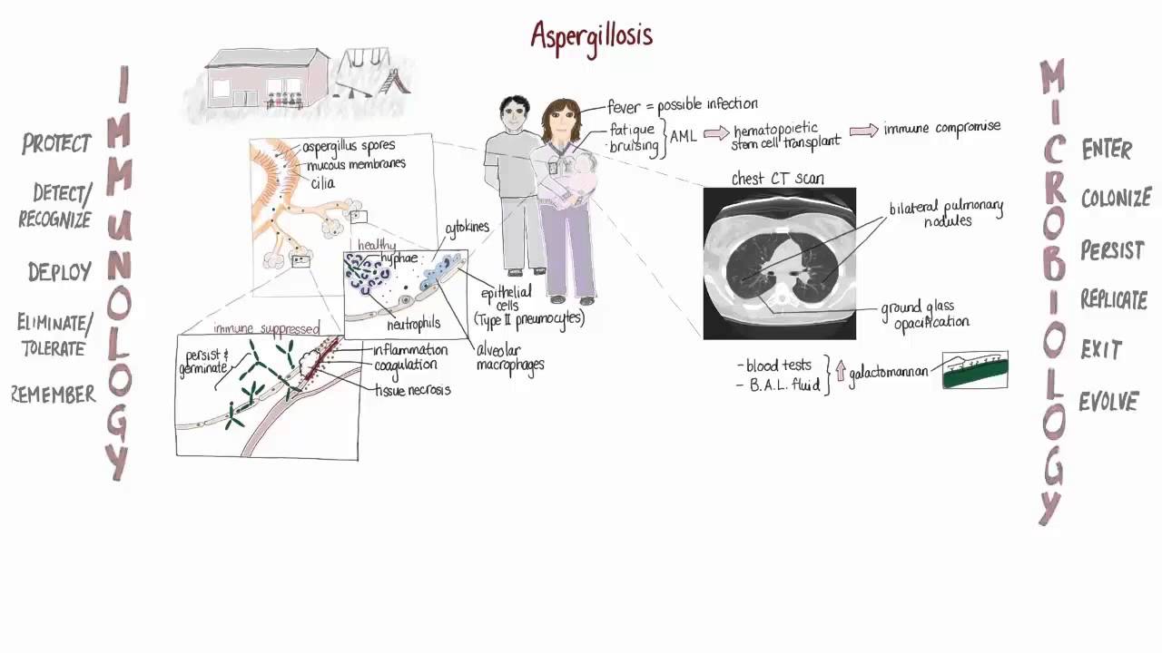 Aspergillus Springboard