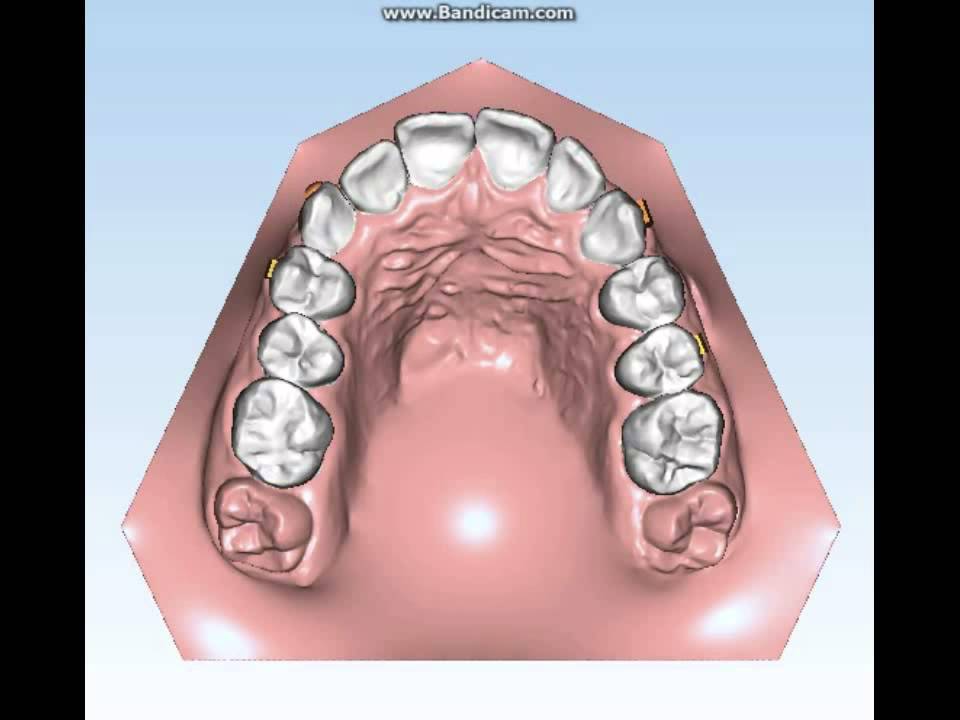 Ortodonzia Invisibile Aurodental 07122015