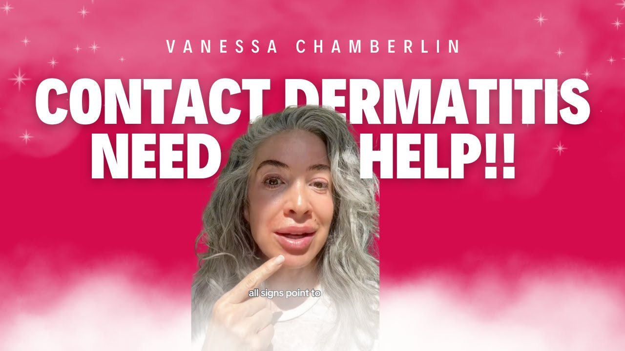 Signs of contact dermatitis | I need help
