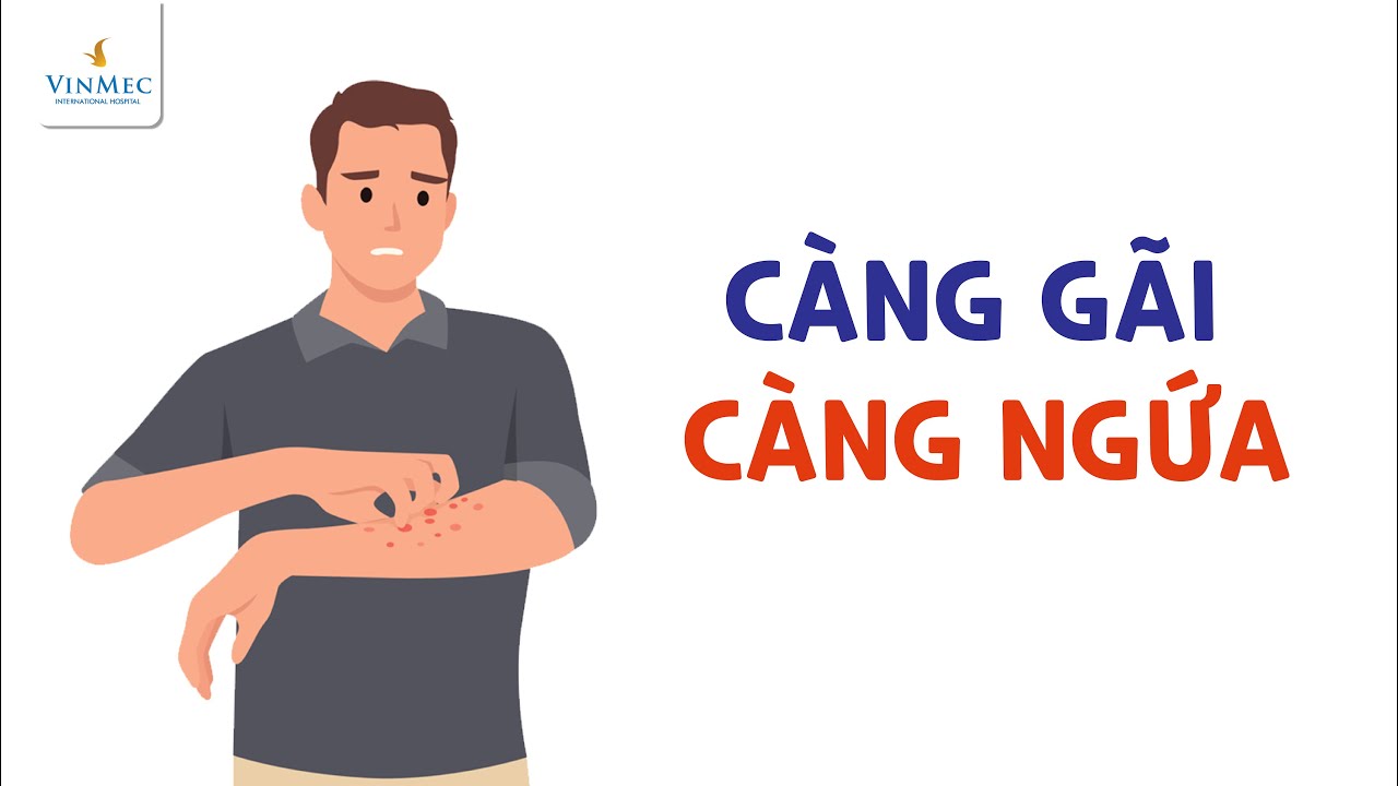 Da bị ngứa c&agrave;ng g&atilde;i c&agrave;ng ngứa - L&agrave;m thế n&agrave;o?