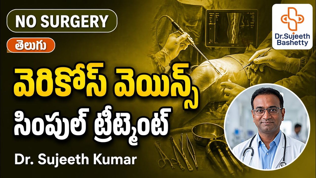వెరికోస్ వెయిన్స్ కి సింపుల్ ట్రీట్మెంట్ | ఆపరేషన్ లేకుండా Dr.Sujeeth Kumar I @dr.sujeeth 