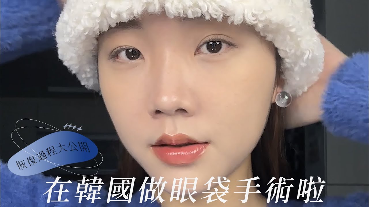 人生第一次整型🤯在韓國跑去做眼袋手術啦！｜割個眼袋真的有差？恢復狀況全記錄✨｜gayogogo
