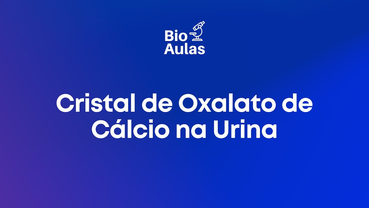 Cristal de Oxalato de C&aacute;lcio na Urina - An&aacute;lises Cl&iacute;nicas | #biomedicine #viral #shorts #like