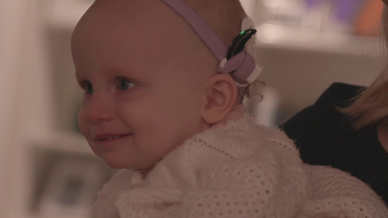 Sound On: 1-year-old Enjoys New World After Cochlear Implants