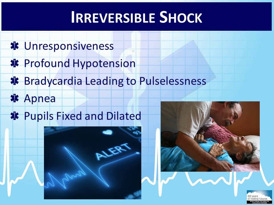 EMT 4-1:  Overview of Shock