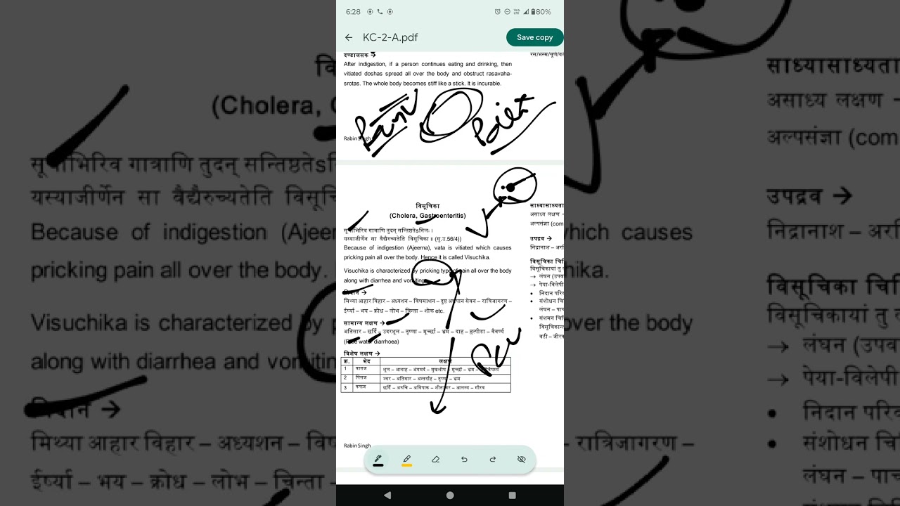 DIFFERENCE BETWEEN AADHMANA,VILAMBIKA, AND VISUCHIKA, ANNAVAHA SROTASA, KC
