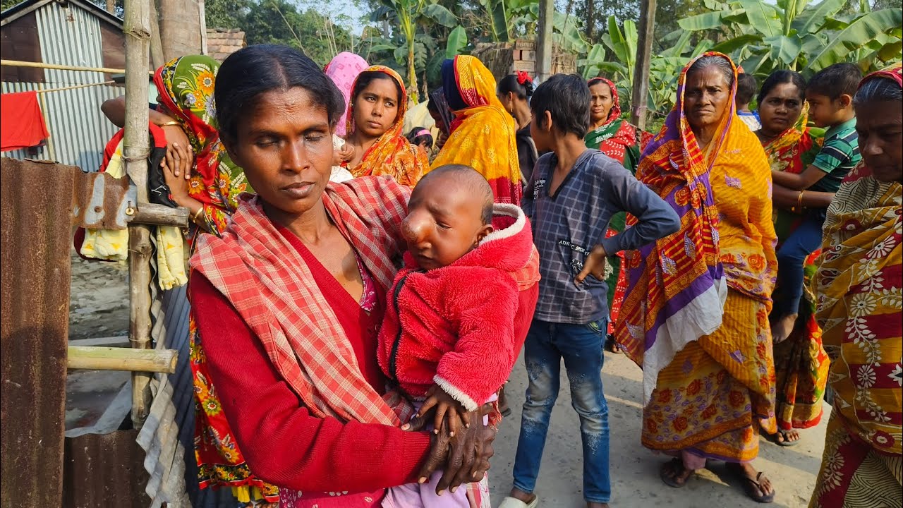 অর্থের অভাবে পাঁচ মাসের ছোট শিশু ভুগছে মরণ ব্যাধিতে। আপনাদের কাছে অনুরোধ করছি পাশে থাকবেন।