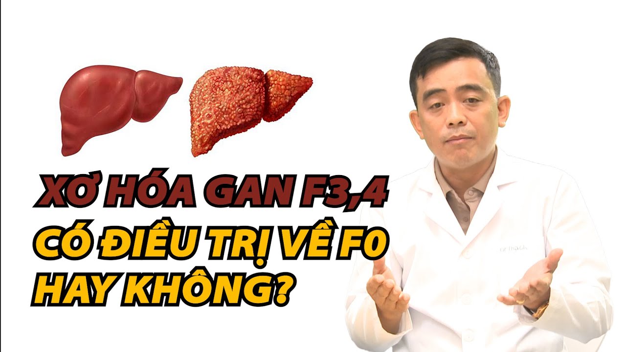 Xơ hóa gan F3,4 có điều trị về F0 hay không? I Dr Thạch