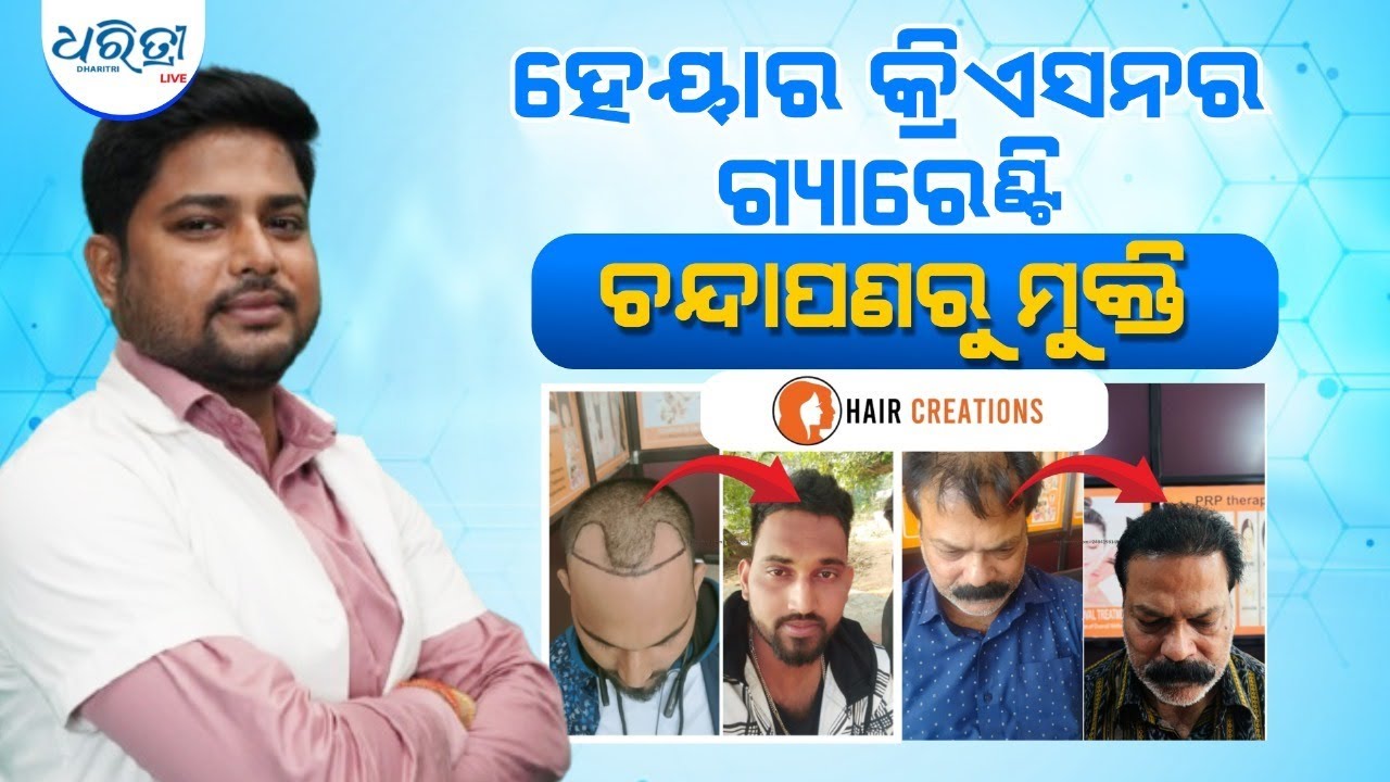 କମ୍ ପଇସାରେ ହେୟାର୍ ଟ୍ରାନ୍ସପ୍ଲାଣ୍ଟ ଏବଂ ବେଷ୍ଟ ରେଜଲ୍ଟ |Hair Creations| Transplant |Surgery |Bhubaneswar