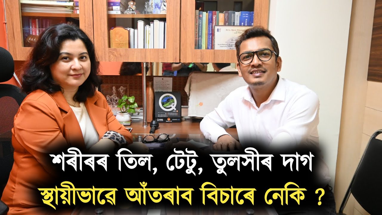 শৰীৰৰ তিল, টেটু, তুলসীৰ দাগ স্থায়ীভাৱে আঁতৰাব বিচাৰে নেকি ?
